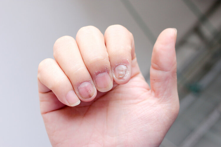 Nail Lunulae & Health: What Your Fingernails Reveal