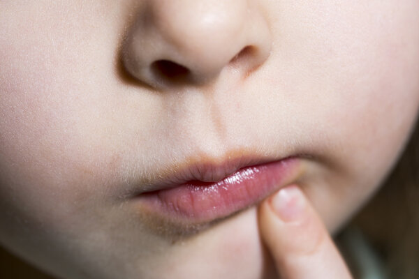 Seasonal Skin Allergies: Prevention, Treatment & Care Guide