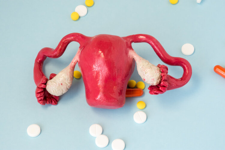 Why are most ovarian cancer cases diagnosed at an advanced stage? Here are 5 symptoms that might indicate your ovaries are crying out for help.